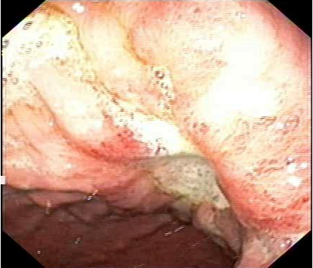 胃の中　内視鏡　コーギー　２
